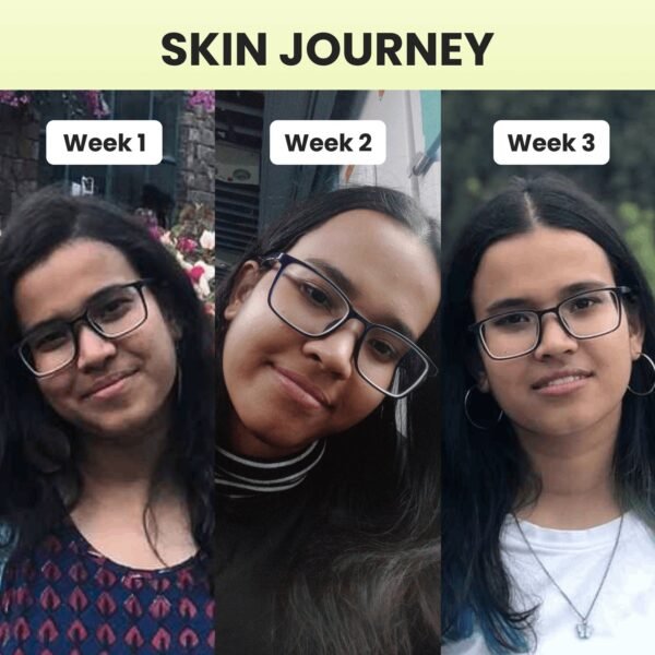 niacinamide-vitamin-b3-20-serum-30ml-544332.jpg niacinamide-vitamin-b3-20-serum-30ml-544332.jpg